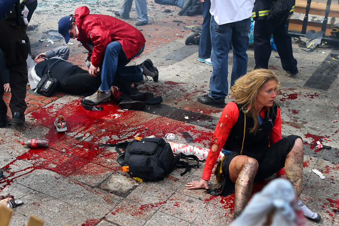 Boston-4/15/13- Kevin Corcoran(left) from Lowell puts his belt on the leg of his wife Celeste to stop the bleeding, as Nicole Gross(rt) from Charlotte, N.C.sits in shock on the sidewalk at the site of the first Boston Marathon bombing near the finish line on the Boylston Street.