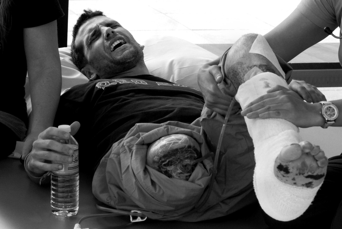 In agony, marathon bomb victim Marc Fucarile receives physical therapy. "It's killing me," he yelled to Jen one night, referring to his "good leg." "I'm telling you. If the pain doesn't stop, I'm going to tell them to take it off."