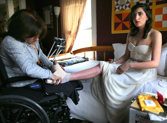 Lowell-5/28/13- Sydney Corcoran a victim of the marathon bombing gets ready for her Lowell High School senior prom as her mother Celeste wraps her foot that was injured in the bombing. A chuck of her foot was destroyed in the bombing that also ripped into her femoral artery. Celeste lost both her legs in the bombing. It was Sydney's dream to go to her prom.