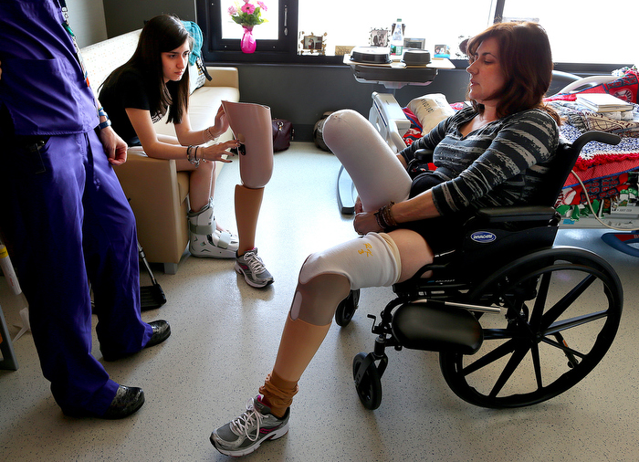 Boston-06/20/13- Celeste Corcoran puts on her right prothesis as her daughter Sydney looks on in Celeste's room at Spaulding Rehab Hospital. Celeste stayed for another week at the hospital after getting her first set of prosthetics. She was discouraged by the clunky feel they had.
