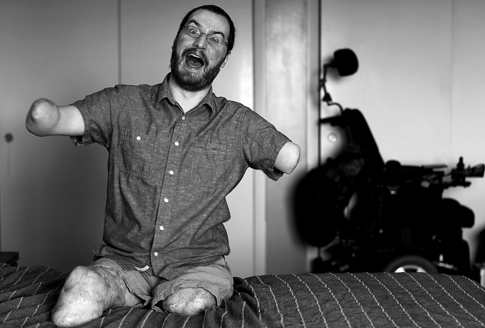 SIT DOWN COMEDIAN: Will Lautzenheiser was an artist, writer and professor when his body was devoured by a flesh-eating bacteria. He lost all four limbs, but not his sense of humor. He became a "sit down" comic, performing around the US. Before he received a rare two-arm transplant, he posed for a photographer.